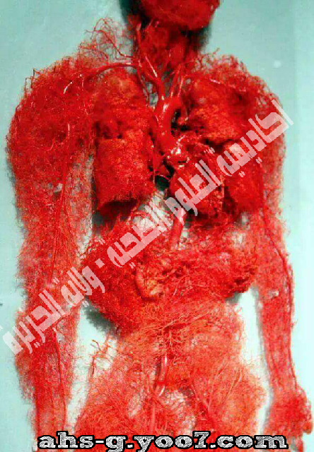 صور تظهر الأوعية الدموية في جسم الانسان P_836tv92d2