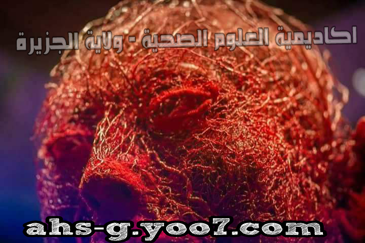 صور تظهر الأوعية الدموية في جسم الانسان P_836y5yzo0