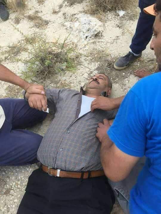 اصابة مواطن خلال اعتداء الاحتلال على المواطنين غرب الخليل